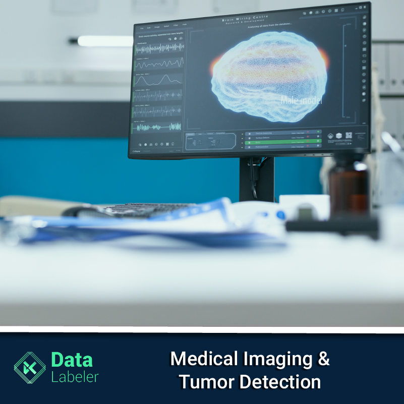 How Artificial Intelligence & Medical Imaging is actively aiding in Tumour Detection?